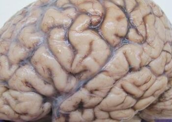 Norrænt samstarf um heilabilun