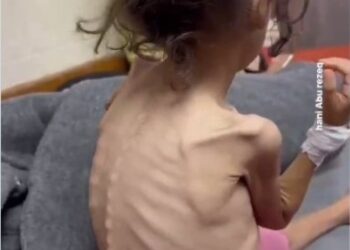 Börnin fá aðeins 245 kaloríur á dag