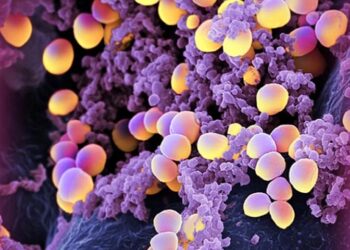 Sýklalyfjaónæmar bakteríur (MÓSA) greinast í fyrsta sinn á Íslandi  