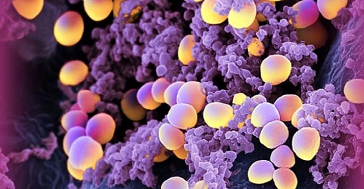 Sýklalyfjaónæmar bakteríur (MÓSA) greinast í fyrsta sinn á Íslandi  